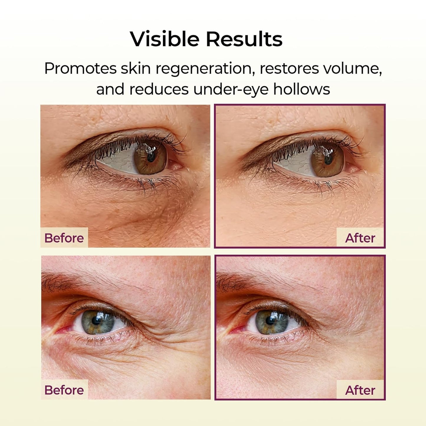 🔥Christmas Special Offer🔥Gifted Collagen Boost five Step Set Calcium Collagen Balm for Firming & Pore Care