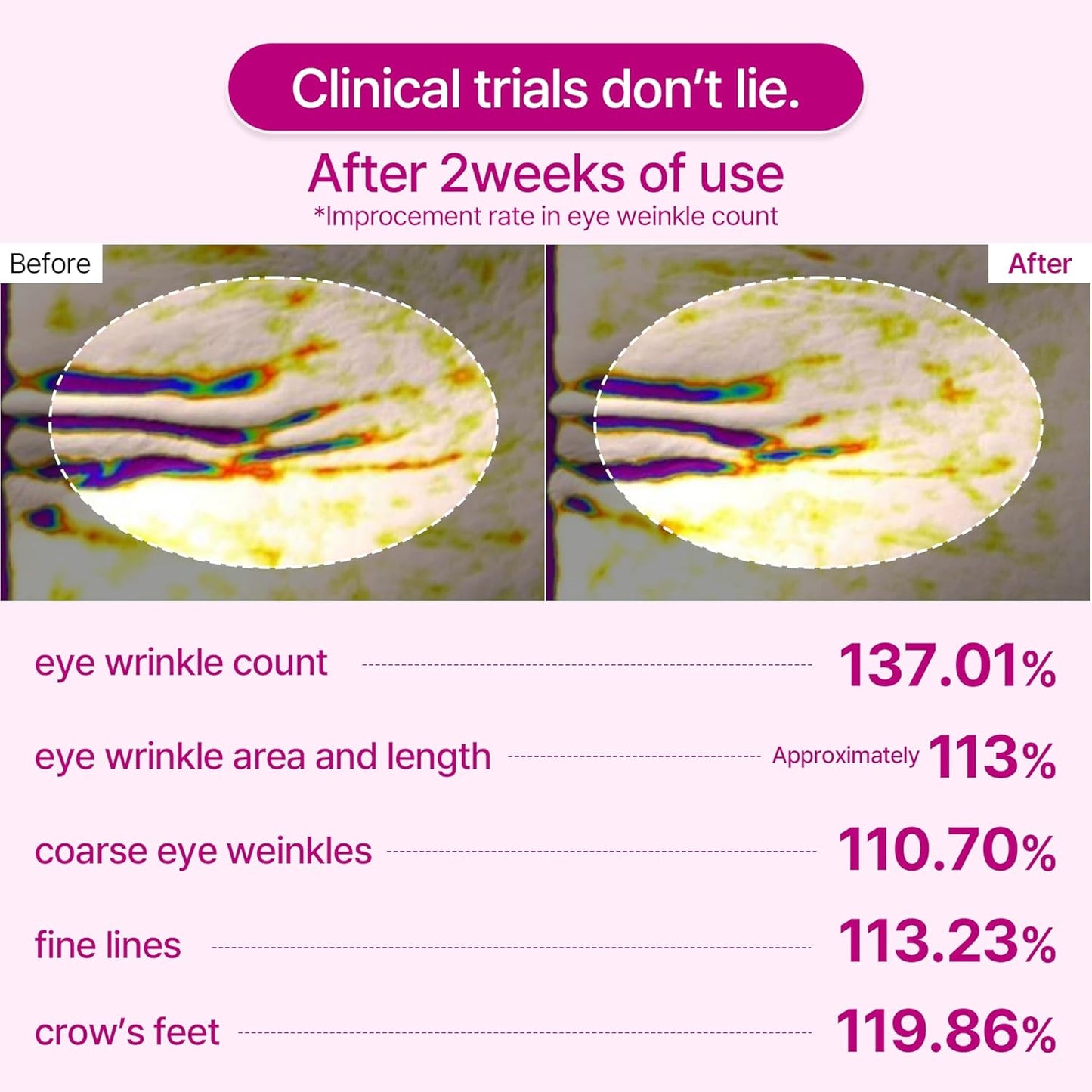 🔥Christmas Special Offer🔥Gifted Collagen Boost five Step Set Calcium Collagen Balm for Firming & Pore Care