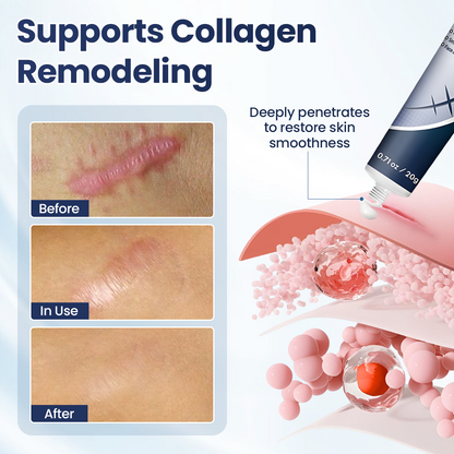 🔥Last Day Discount🔥 LOVILDS® Texture Repair Gel