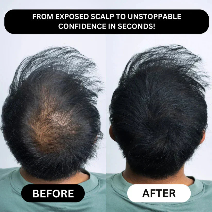 🔥Limited-Time Holiday Offer-Thicker-Looking Hair in 30 Seconds. Confidence All Day.